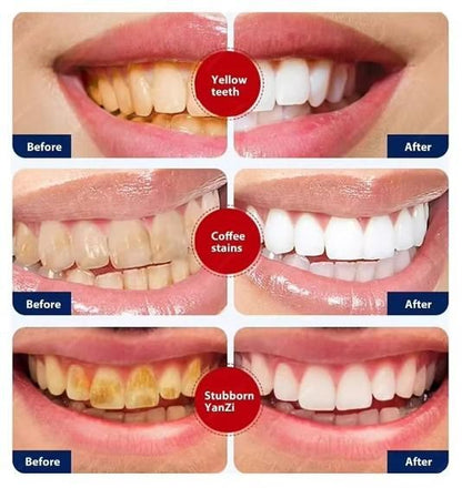 BrightSmile™ Stain-Removal Toothpaste – Instantly Whitens Teeth (Pack of 2)