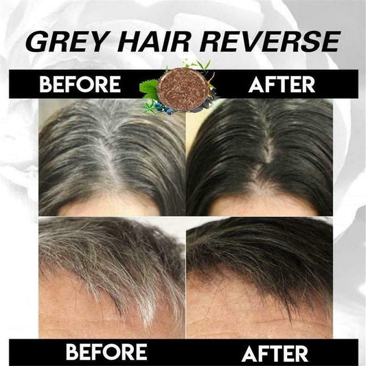GreyGone™ Organic Reverse Shampoo & Conditioner Bar – Restore Natural Hair Color (Pack of 2)