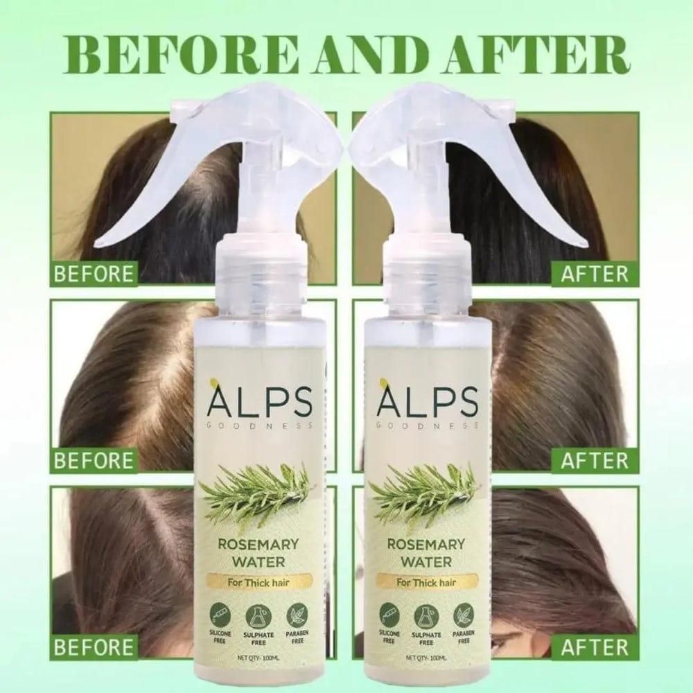 RoseMend™ Hair Regrowth Spray – Buy 1 Get 2 FREE | Natural & Powerful Herbal Formula