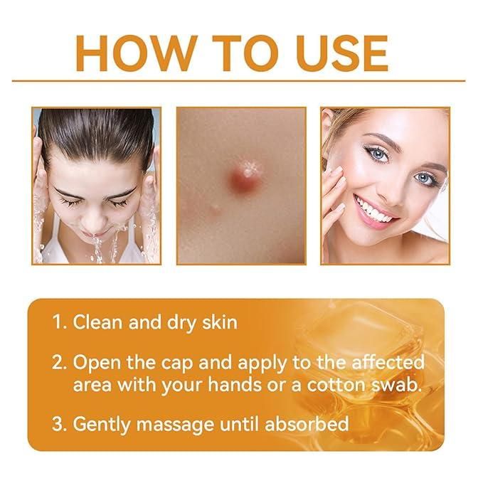BeeGlow™ Skin Renewal Cream – Natural Healing & Blemish Removal
