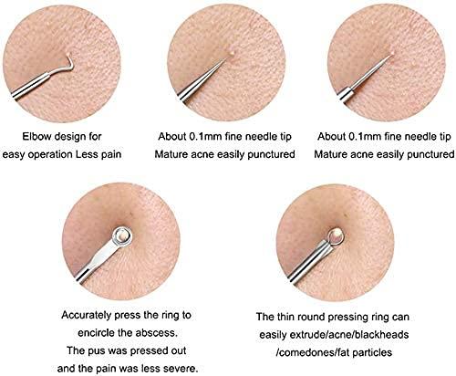 ClearSkin™ Stainless Steel Blackhead & Acne Extractor Set (4 Pcs) – Instant Pore Cleansing
