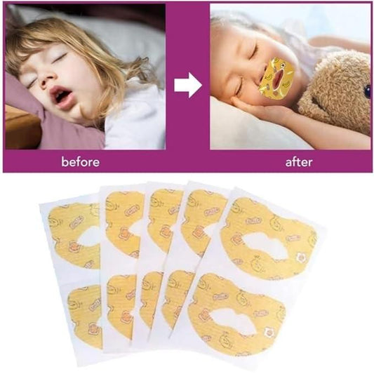 SleepEasy™ Anti-Snoring Breath Strips – Enjoy Peaceful, Snore-Free Nights! (30 Pcs)
