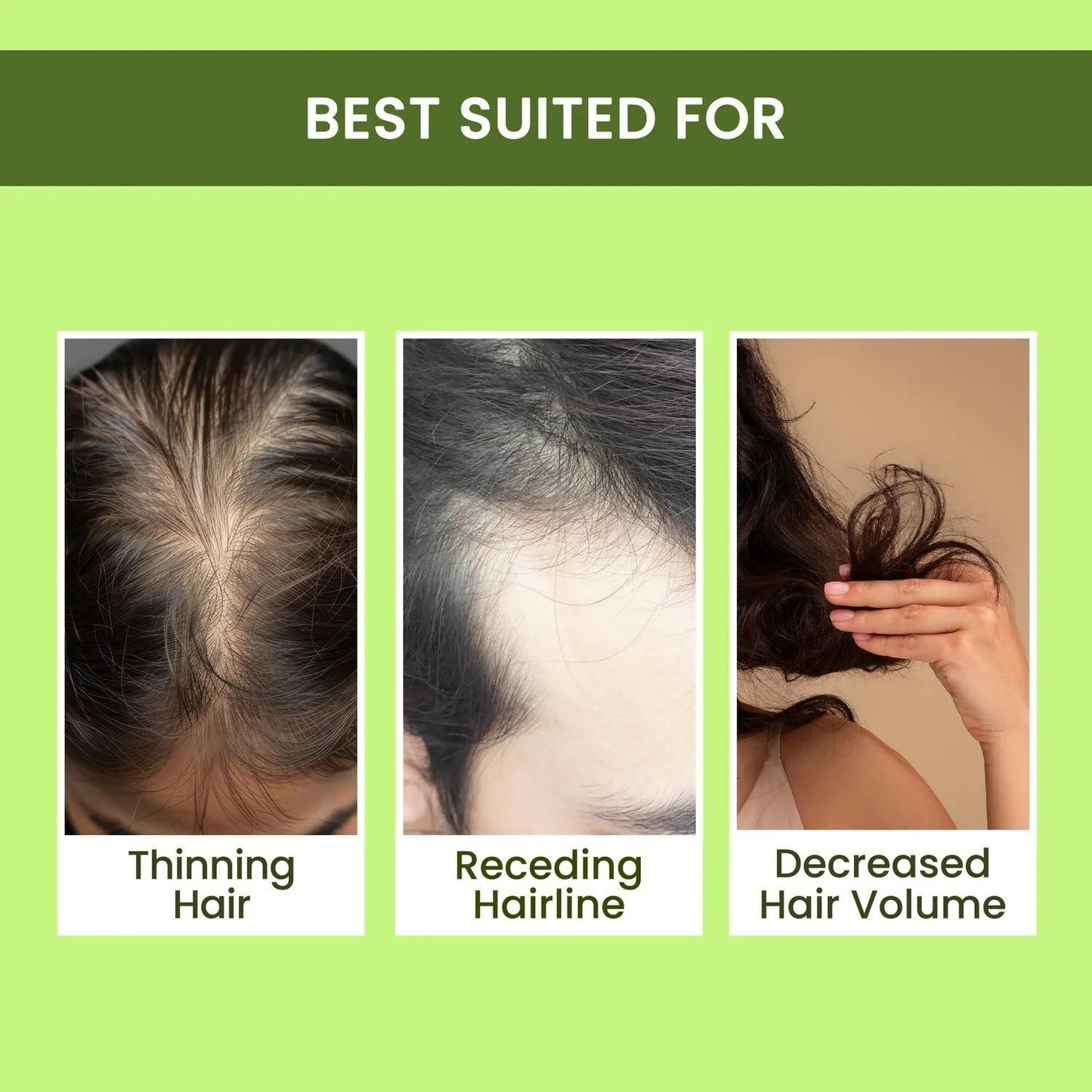 RoseMend™ Hair Regrowth Spray – Buy 1 Get 2 FREE | Natural & Powerful Herbal Formula