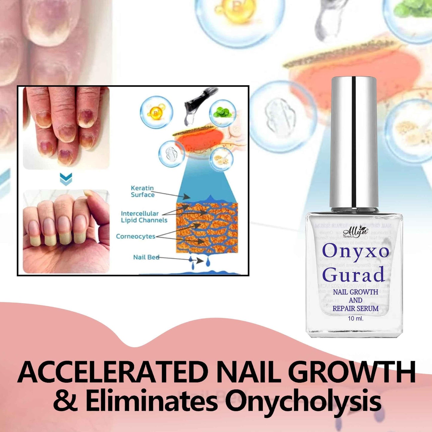 OnyxoGuard™ Nail Growth & Repair Serum (Pack of 2) – Heals Damage & Boosts Growth Fast