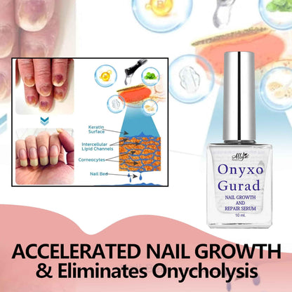OnyxoGuard™ Nail Growth & Repair Serum (Pack of 2) – Heals Damage & Boosts Growth Fast