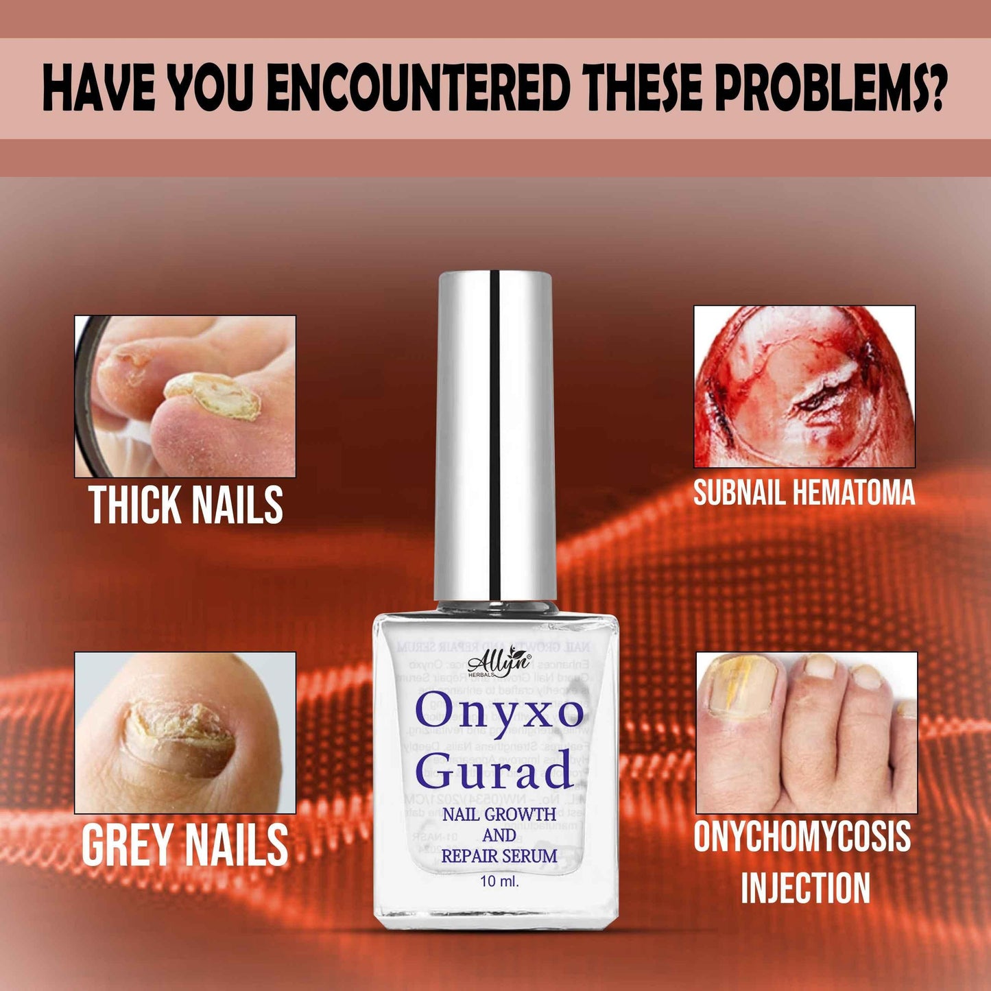 OnyxoGuard™ Nail Growth & Repair Serum (Pack of 2) – Heals Damage & Boosts Growth Fast