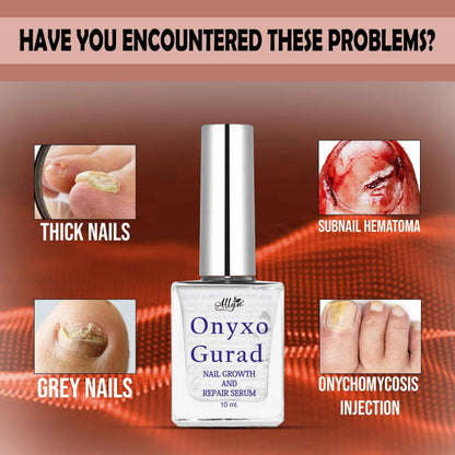 OnyxoGuard™ Nail Growth & Repair Serum (Pack of 2) – Heals Damage & Boosts Growth Fast