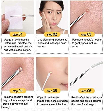 ClearSkin™ Stainless Steel Blackhead & Acne Extractor Set (4 Pcs) – Instant Pore Cleansing