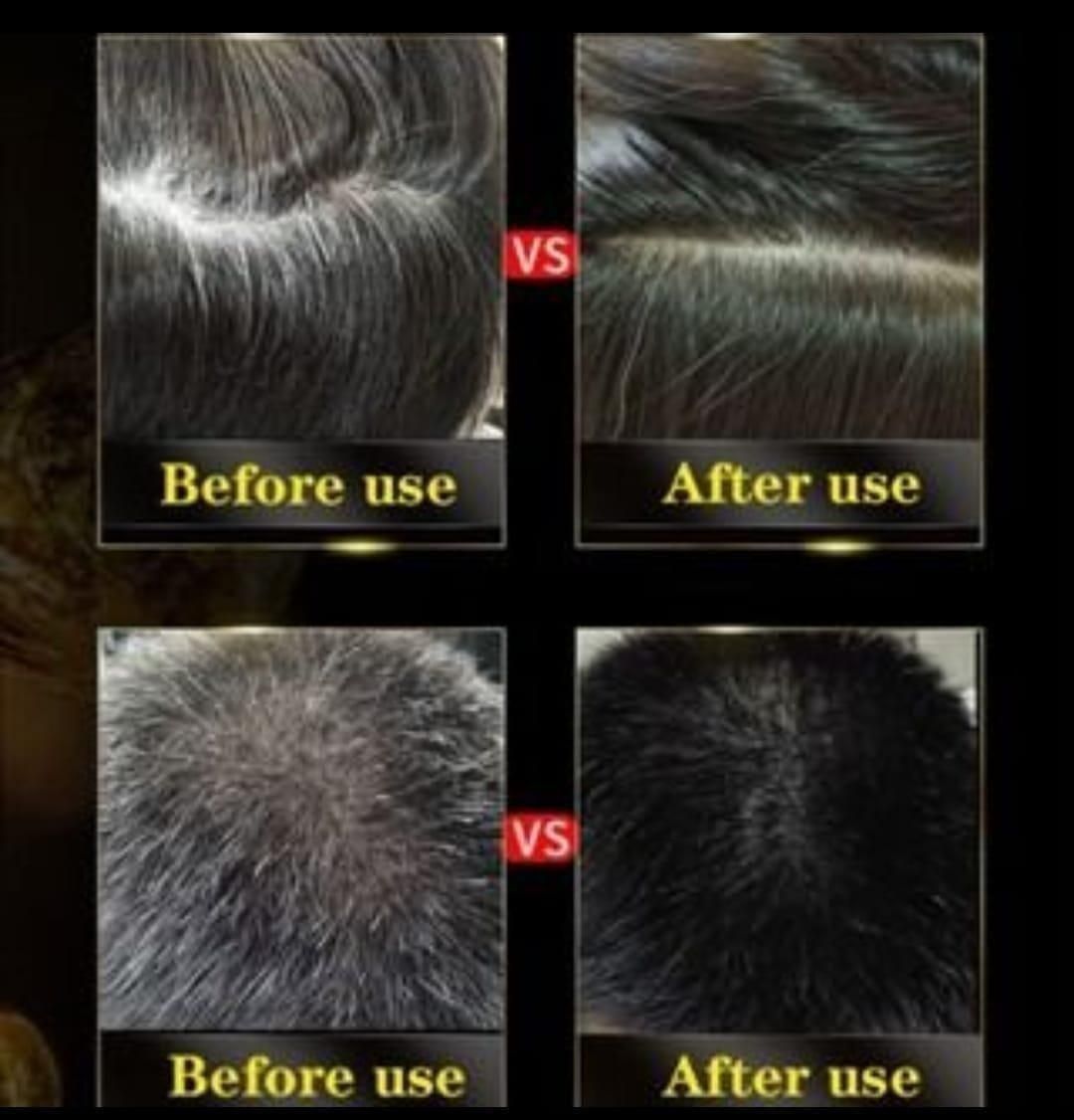 InstaBlack™ Herbal Hair Dye Shampoo – 3-in-1 Formula for Instant Grey Coverage (Pack of 2)
