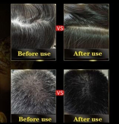 InstaBlack™ Herbal Hair Dye Shampoo – 3-in-1 Formula for Instant Grey Coverage (Pack of 2)