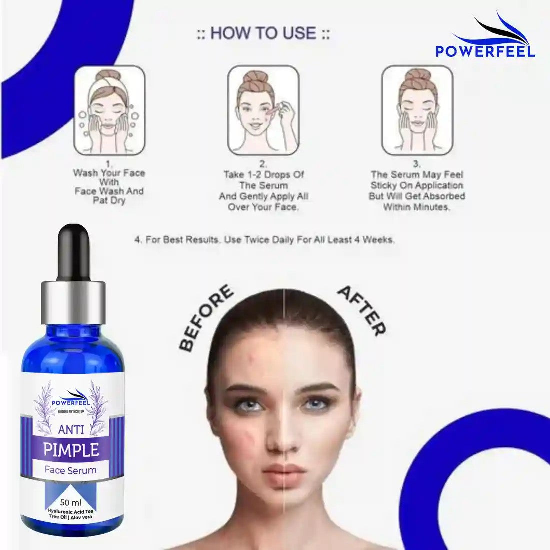 ClearGlow™ Anti-Pimple Face Serum – Removes Dark Spots & Blemishes for Radiant Skin