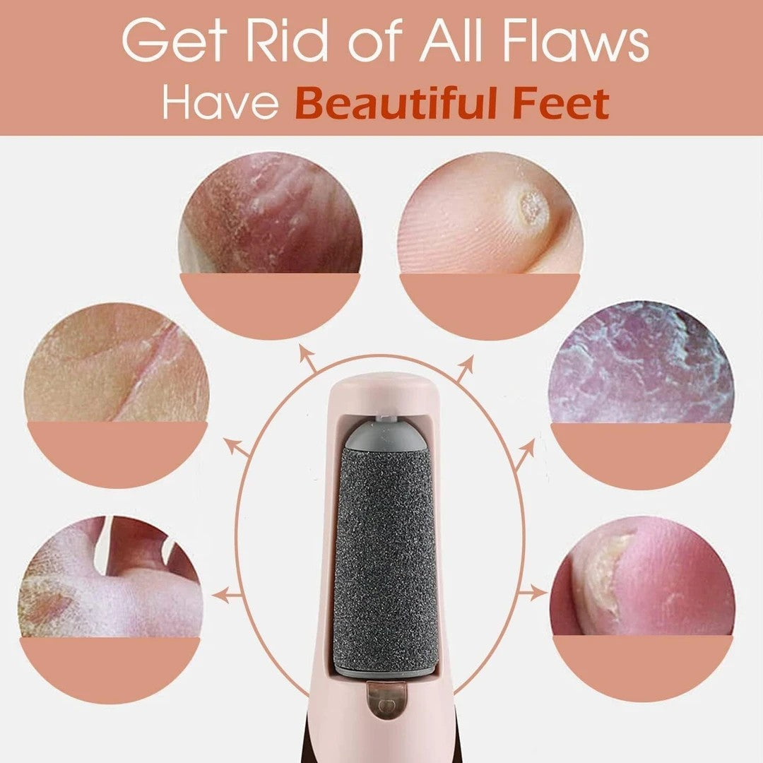 PediGlow™ Dual-Speed Callus & Foot File Remover – Reveal Baby-Soft Feet Instantly