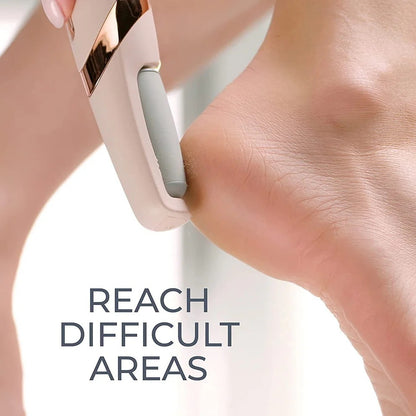 SmoothSteps By Ankaa, Electronic Cordless Pedicure & Callus Remover–Salon-Quality Foot Care