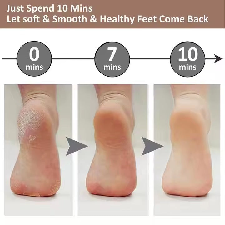 SmoothSteps By Ankaa, Electronic Cordless Pedicure & Callus Remover–Salon-Quality Foot Care