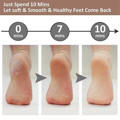 SmoothSteps By Ankaa, Electronic Cordless Pedicure & Callus Remover–Salon-Quality Foot Care