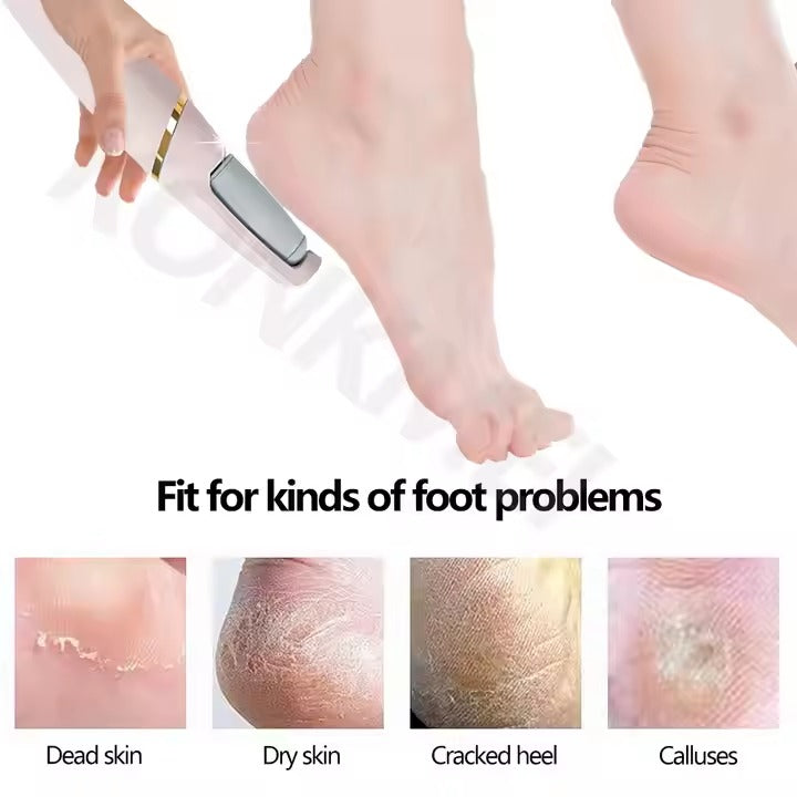 SmoothSteps By Ankaa, Electronic Cordless Pedicure & Callus Remover–Salon-Quality Foot Care