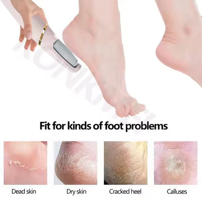 SmoothSteps By Ankaa, Electronic Cordless Pedicure & Callus Remover–Salon-Quality Foot Care