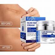 Kurai™ Scar Removal Cream Gel – Advanced Acne Spot, Stretch Mark & Burn Repair Treatment